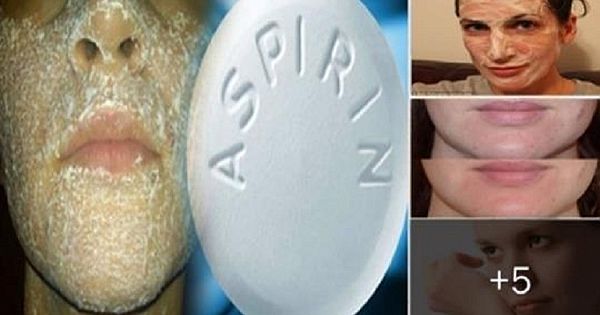 Aspirinin Ciltteki Mucizevi Etkisi