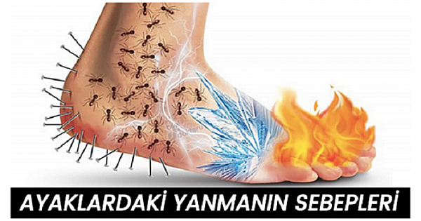 Ayaklarda Y-anma Neden Olur – Ayak Y-anması Sebepleri