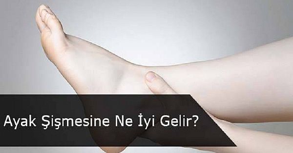 Şişmiş ayaklar için çözüm mü arıyorsunuz? işte 4 öneri