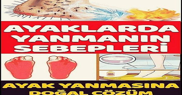 Ayaklarda Y-anma Neden Olur – Ayak Y-anması Sebepleri