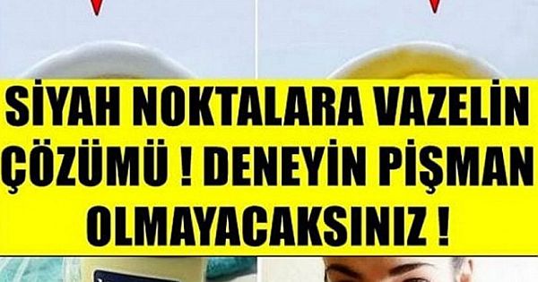 SİYAH NOKTALARA VAZELİN ÇÖZÜMÜ! DENEYİN PİŞMAN OLMAYACAKSINIZ!