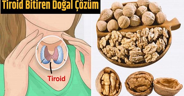 TİROİD BİTİREN DOĞAL ÇÖZÜM