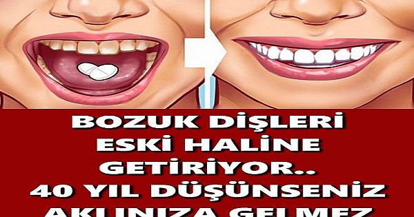 BOZUK DİŞLERİ ESKİ HALİNE GETİRİYOR, 40 YIL DÜŞÜNSENİZ AKLINIZA GELMEZ