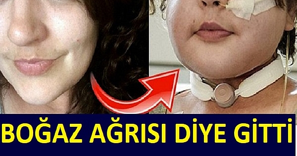 BOĞAZ AĞRISI DİYE GİTTİ DOKTOR GERÇEĞİ AÇIKLADI