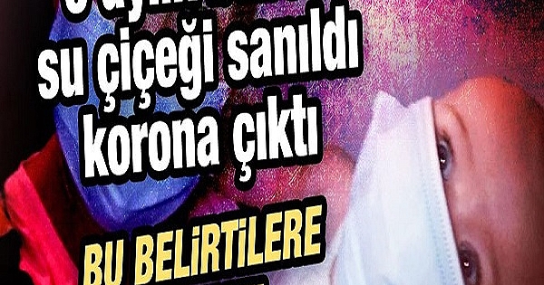 Suçiçeği dediler 5 aylık bebek korona çıktı 