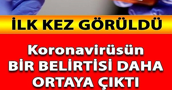 Koronavirüsün EN SİNSİ Belirtisi Ortaya Çıktı 