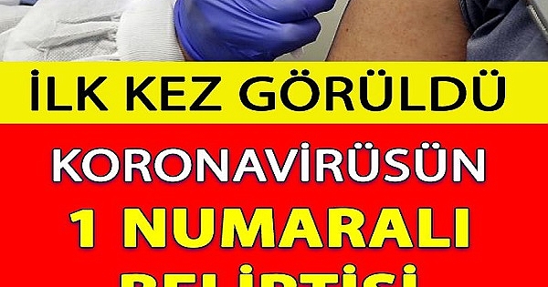 Koronvirüsün 1 numaralı belirtisi değişti. Ateş ve öksürüğün yerini aldı 