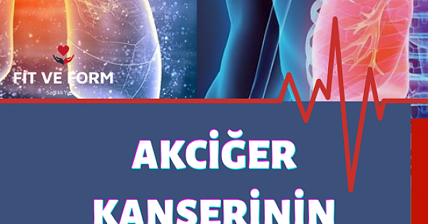 Akciğer Kanseri Belirtileri Nelerdir?