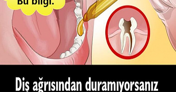 Dişinizde sızlanmanız var ise!