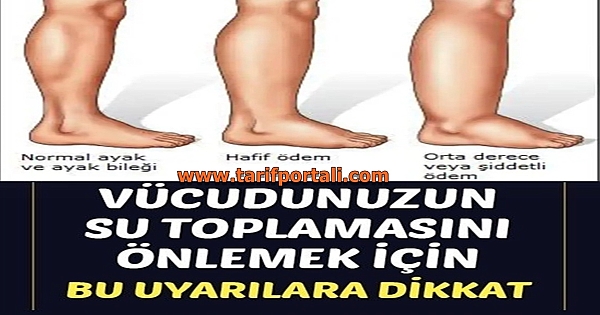 Vücudunuzdaki ödemi azaltmak için bu formülü deneyin!